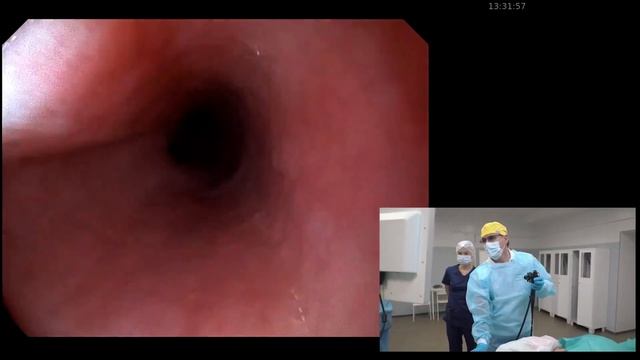 Видеоэндоскопическая система на базе SonoScape HD-500 смотреть онлайн