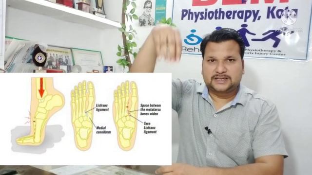 foot fracture recovery time | tarsal bones fracture | foot tarsal bone recovery | in hindi смотреть онлайн