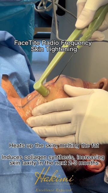 Neck Lipo смотреть онлайн