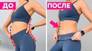 Выпирает живот, гиперлордоз и боль в пояснице? Делай всего ОДНО упражнение