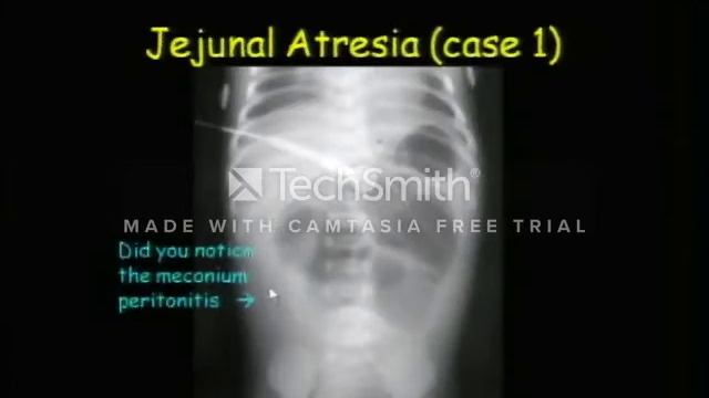 GIT Peds cases смотреть онлайн