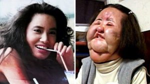 В это сложно поверить, но это одна и та же женщина. Ханг Миоку - Дама, которая испортила себе лицо.