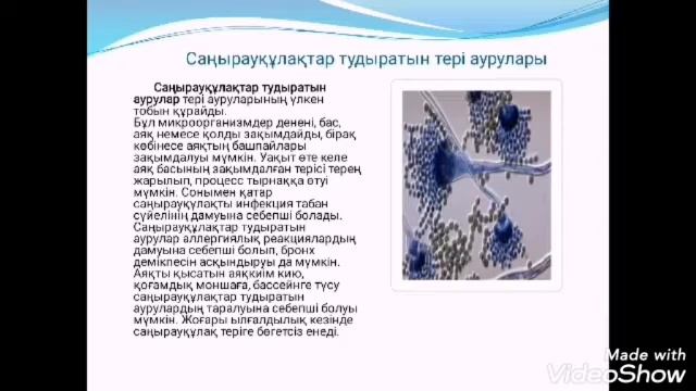 Тері ауруларының пайда болу себептері мен салдары (қышыма, теміреткі, безеу бөртпелері). 8-сынып смотреть онлайн
