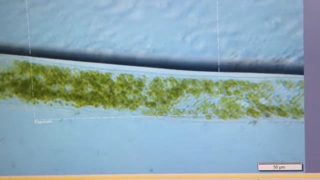 symbiotic chlorella algae in ciliate Spirostomum смотреть онлайн