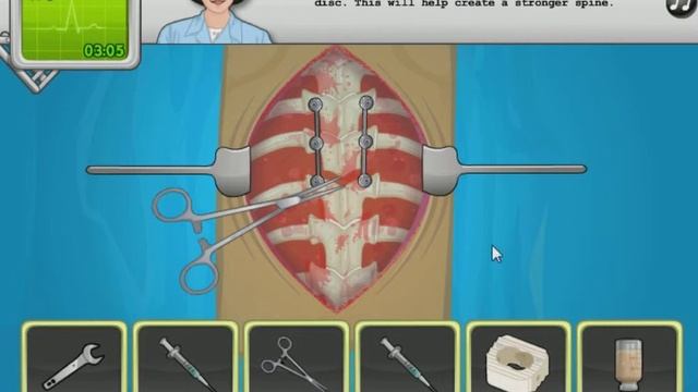OPERATE NOW: SCOLIOSIS SURGERY