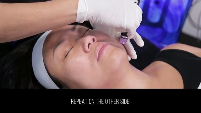 HydraFacial Purple Tip Training Protocol смотреть онлайн