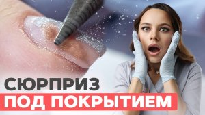 ШОК! Это выглядело как ГРИБОК | Сюрприз под покрытием 🤢