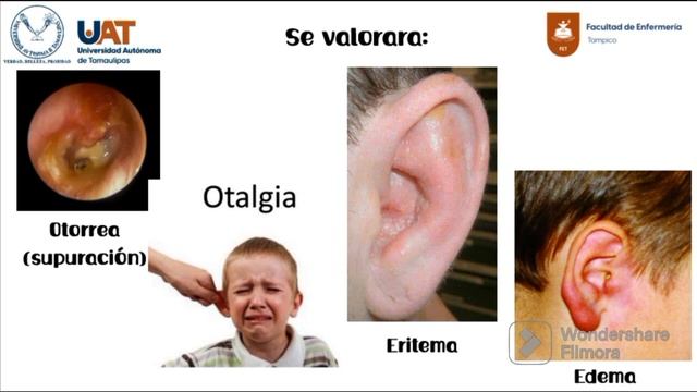 Valoración Pediátrica Preescolar смотреть онлайн