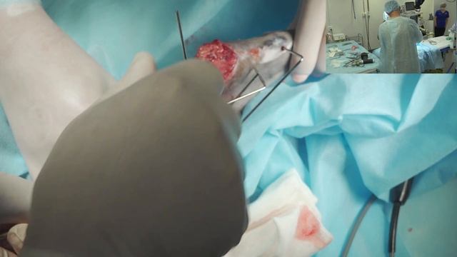 Травматический вывих коленной чашки у кошки смотреть онлайн