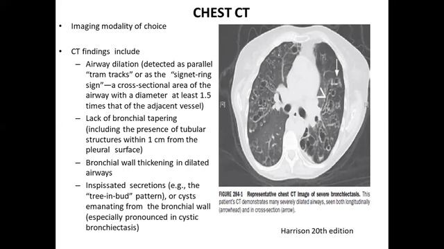 Bronchiectasis | Respiratory Lecture-4 смотреть онлайн
