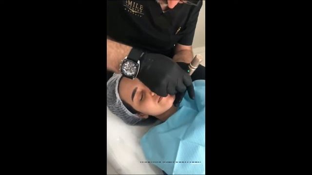 Dermapen with MESO-Cocktail (Vitamins and Minerals) with Dr Waled Abdel Malak смотреть онлайн