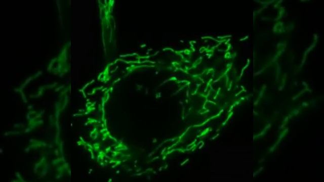 vídeo mitocondria em fibroblastos смотреть онлайн
