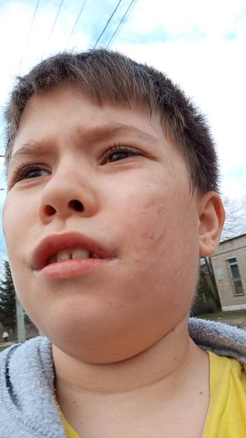 ViD181811773737636
