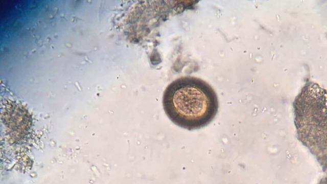 PLATELMINTOS - Huevo Taenia - Laboratorio de Parasitología - Hospital Rawson, Córdoba смотреть онлайн