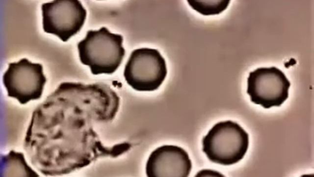 Охота лейкоцита за вредоносным анентом смотреть онлайн