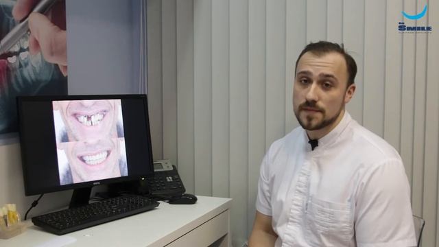 Дентальные имплантаты. Анисимов Р. С. (Клиника Dr.Smile) смотреть онлайн