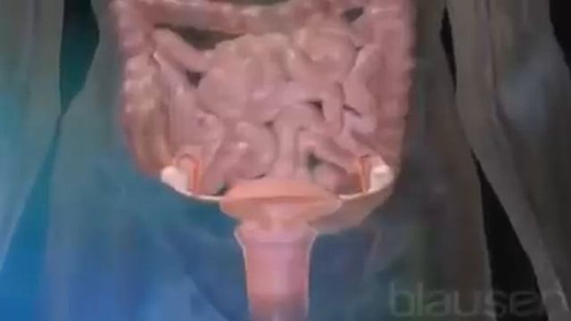 Внематочная беременность смотреть онлайн