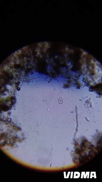 инфузория сувойка