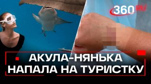Акула укусила россиянку на Мальдивах