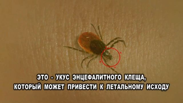 ролик Клещи смотреть онлайн