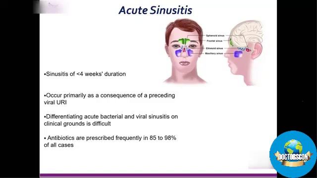 Approach To Upper Respiratory Tract Infections By Prof. Dr. Sameer Raisuddin Qureshi