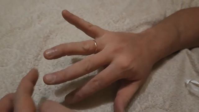 Травма пальца смотреть онлайн