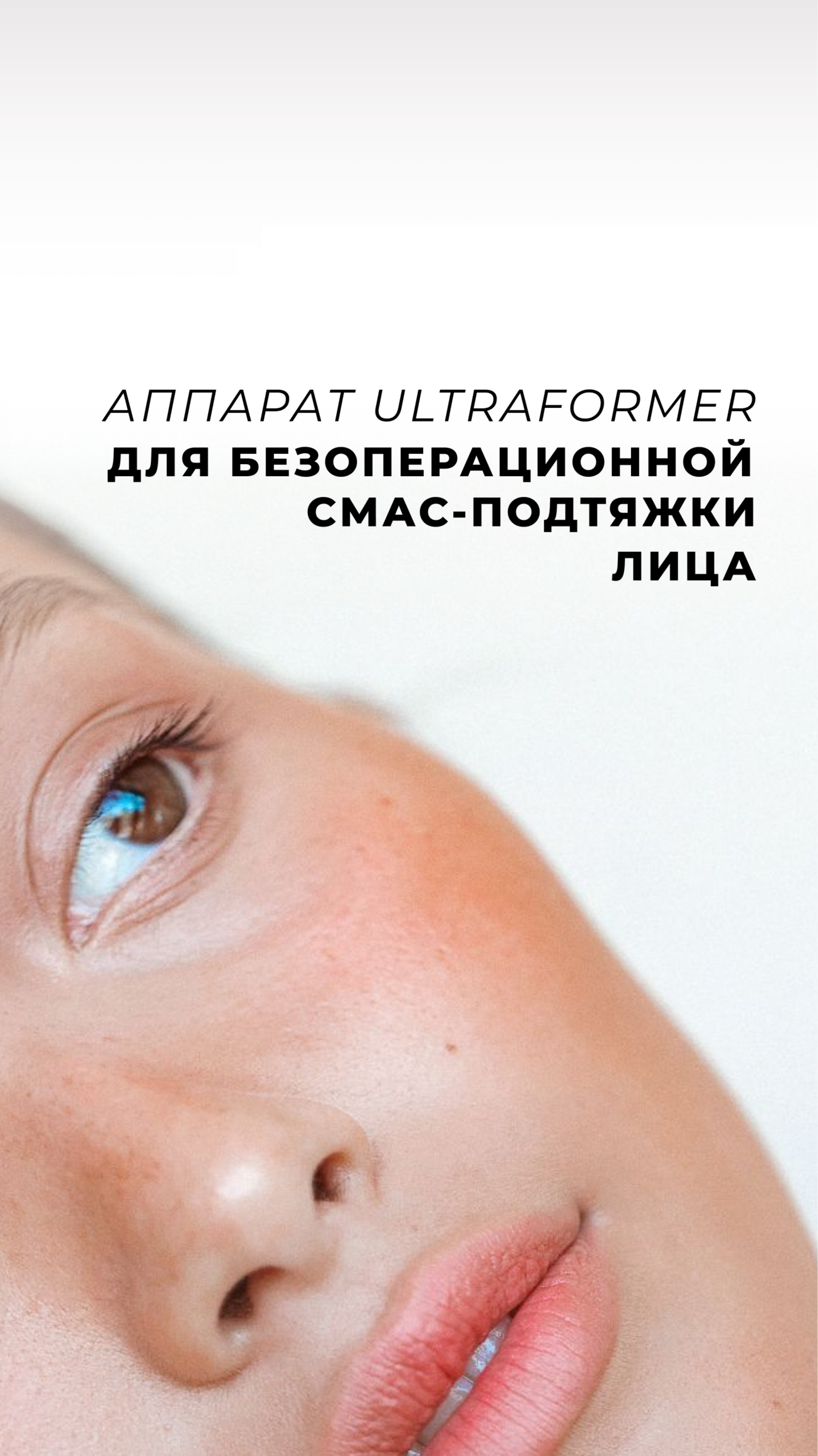 Ультразвуковой SMAS-лифтинг — омоложение без операции!