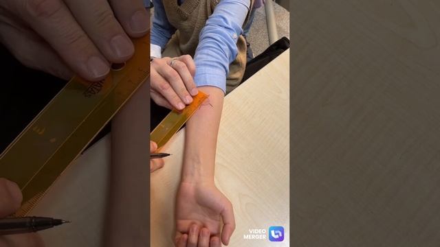 Yapılan PPD testinin okunması смотреть онлайн