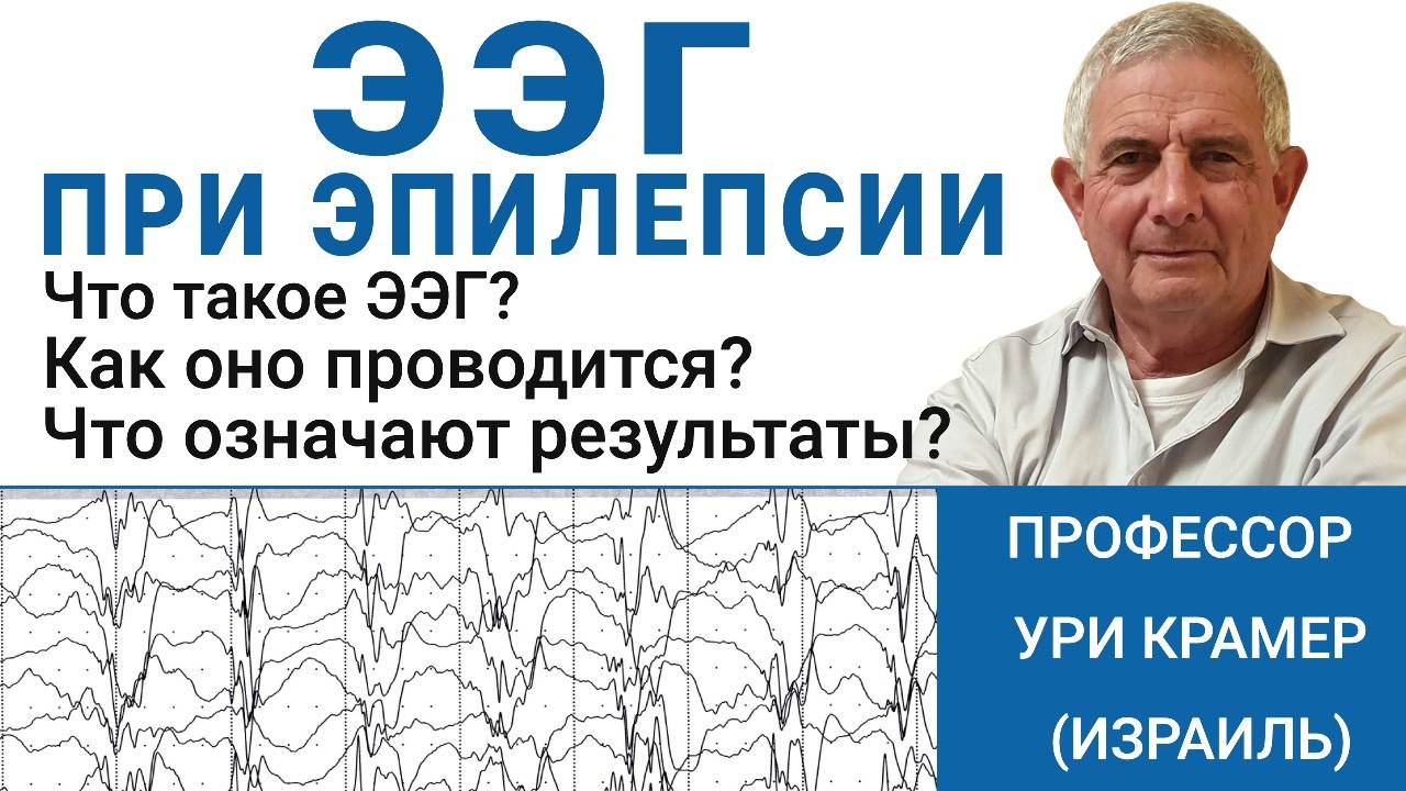 Что такое ЭЭГ? Как делают проверку и что она показывает? Отвечает профессор Ури Крамер смотреть онлайн