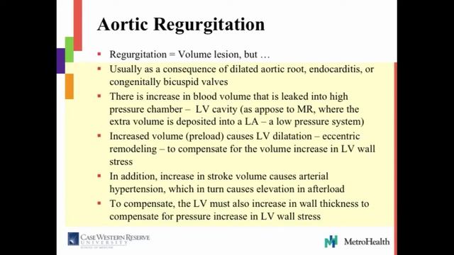 Valvular Heart Disease Aortic Stenosis and Regurgitation смотреть онлайн