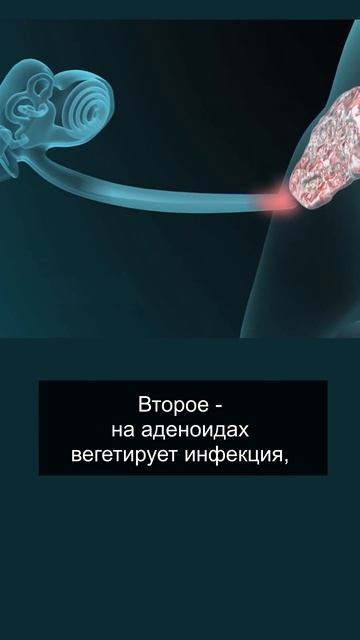 ПОЧЕМУ ПРИ АДЕНОИДАХ НАРУШАЕТСЯ СЛУХ смотреть онлайн