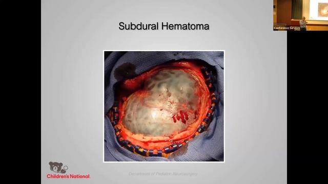 Closed Head Injuries-Trauma Core 2023 (Expires 10/20/2025) смотреть онлайн