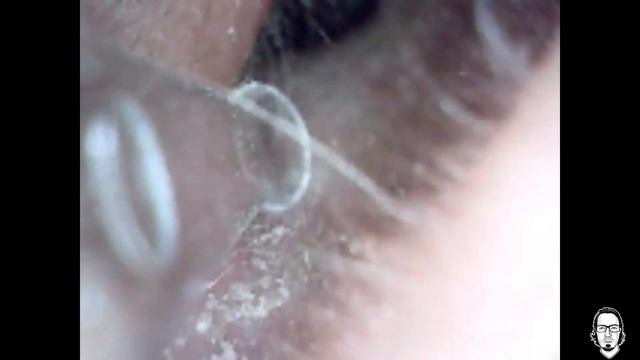 Visual Ear Pick Review