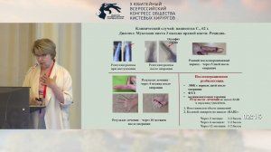 Чуловская И.Г.: мукозные кисты пальцев кисти, ошибки диагностики и лечения.