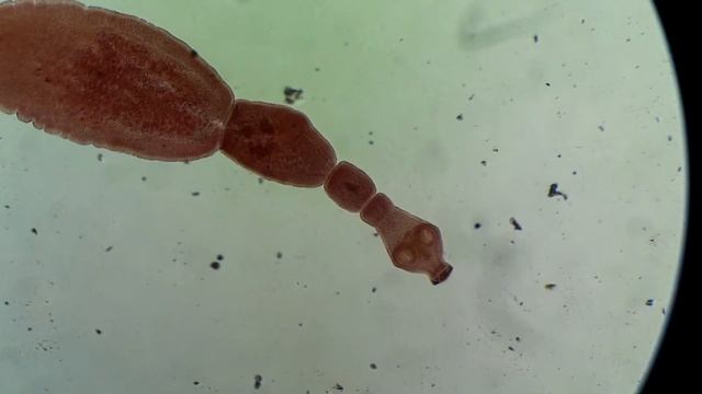 17 Echinococcus granulosus Parásito adulto смотреть онлайн