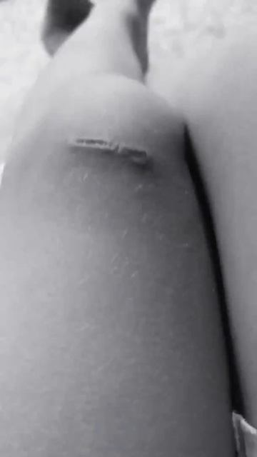 как сильно поранился ☠ смотреть онлайн