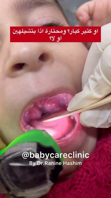 عم تعاني مع طفلك بالتهابات متكررة باللوزتين؟