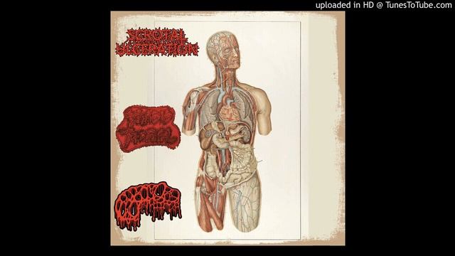Scrotal Ulceration / Miasis Tropical / Paraphimosis - Split смотреть онлайн