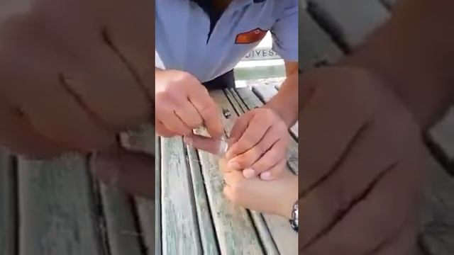 Как снять кольцо с пальца смотреть онлайн
