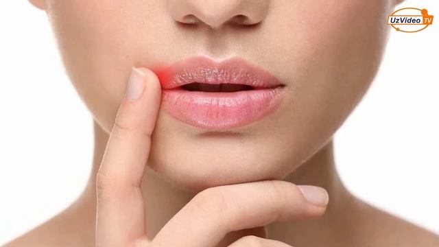 Labga Uchuq Chiqsa Nima Qilish Kerak - Uy Sharoitida Nima Qilish Mumkin Va Kosmetika Bilan !!!