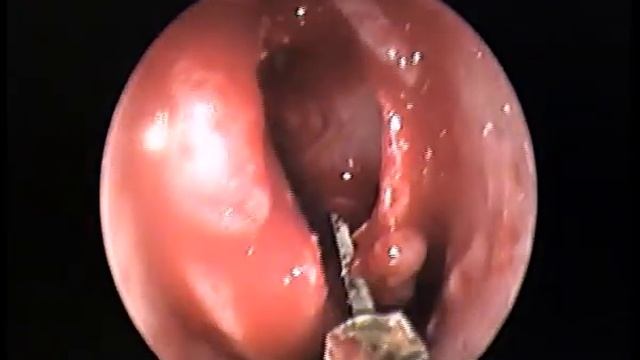 MediumConchotomia смотреть онлайн