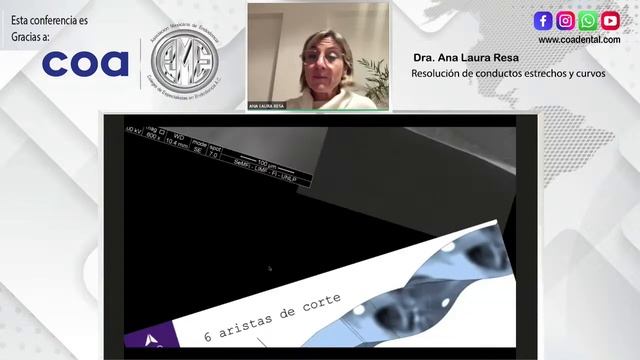 1632 Resolución de conductos estrechos y curvos смотреть онлайн