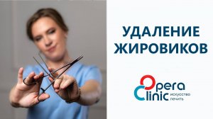 Удаление жировиков (липом и атером)