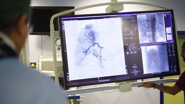 Y-90 Radioembolization: Role of the Radiographer and current techniques in Interventional Oncology смотреть онлайн