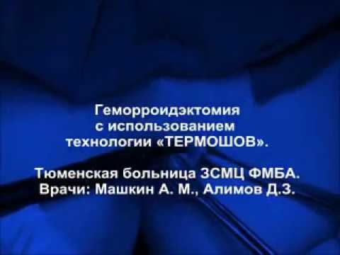 Геморроидэктомия с использованием технологии 