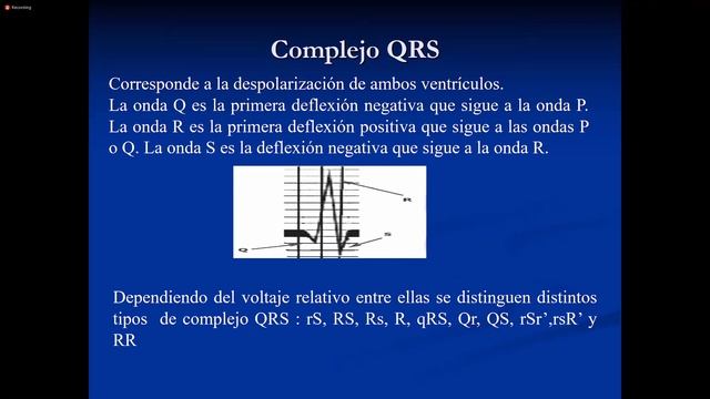 03. MI Electrocardiograma (Dr Miguel) 26/05/21
