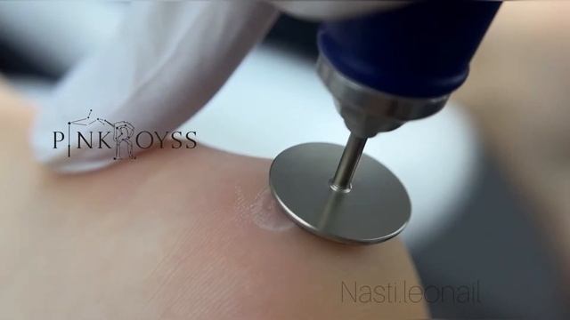 Обработка мозоли на ноге