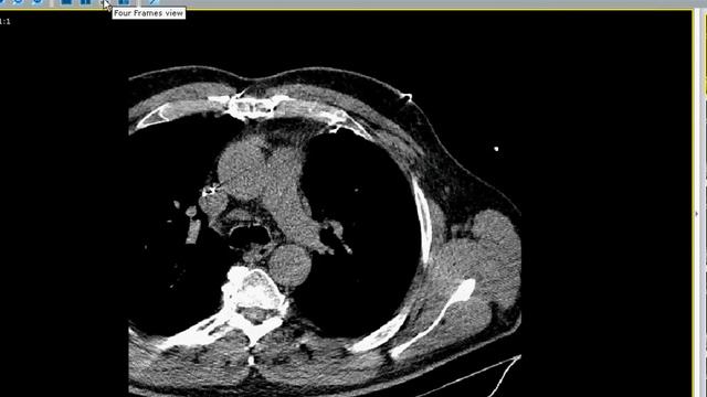 Flash dicom viewer in action - Web demonstration смотреть онлайн