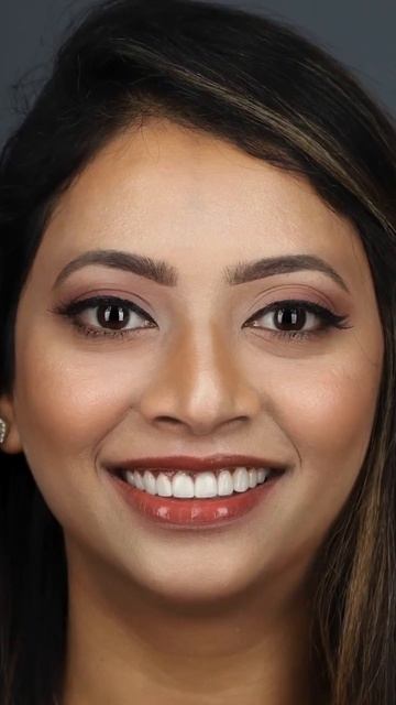 Transformed another fellow dentists smile 🙏🏼 What a transformation! #shorts #dentist #cosmetic смотреть онлайн