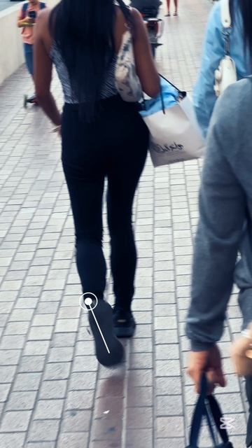 косолапость - это следствие переднего наклона таза смотреть онлайн